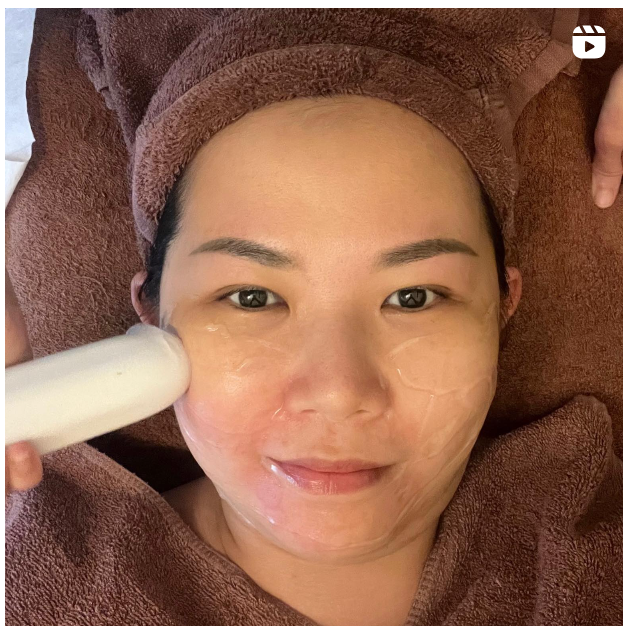 IMALIFT Lifting Facial Singapore | Facial Treatment | Chrysalis