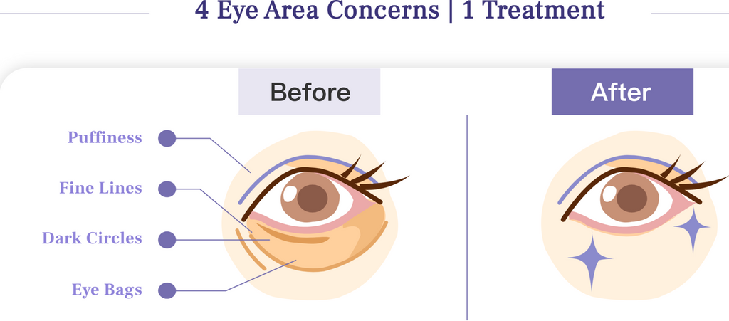 Eye Care Before And After | Chrysalis