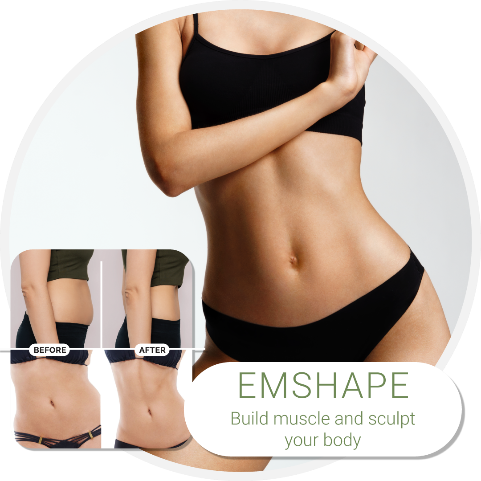 EMShape Voucher | Chrysalis 