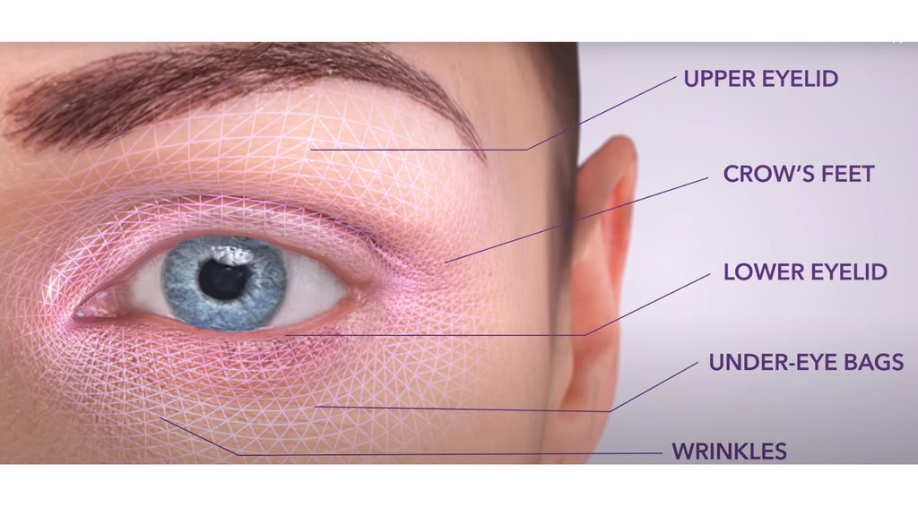 Endymed 3Deep Eye Treatment Singapore | Chrysalis