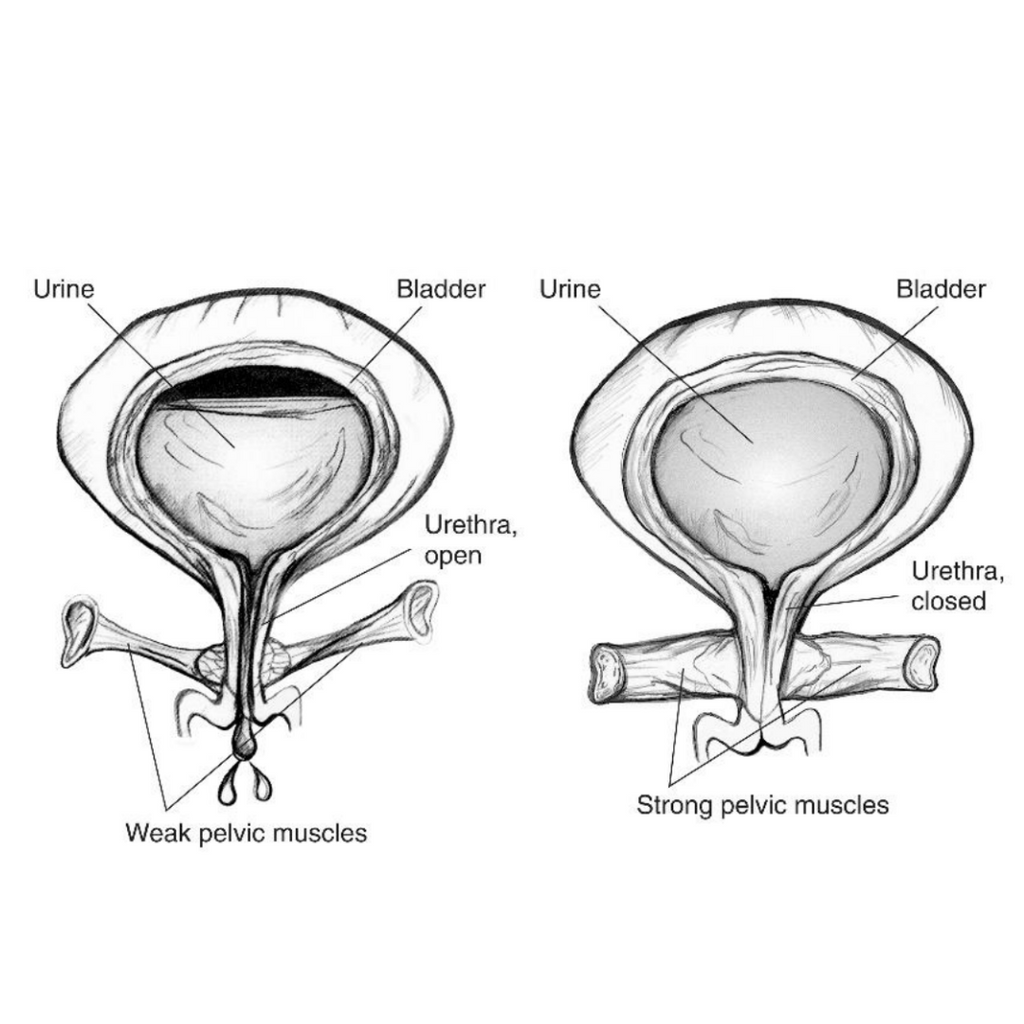 Kegel Exercise | Chrysalis