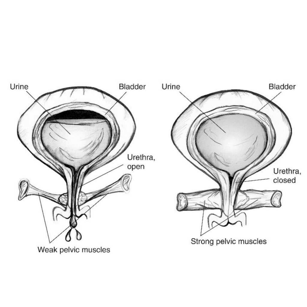 Kegel Exercises | Chrysalis