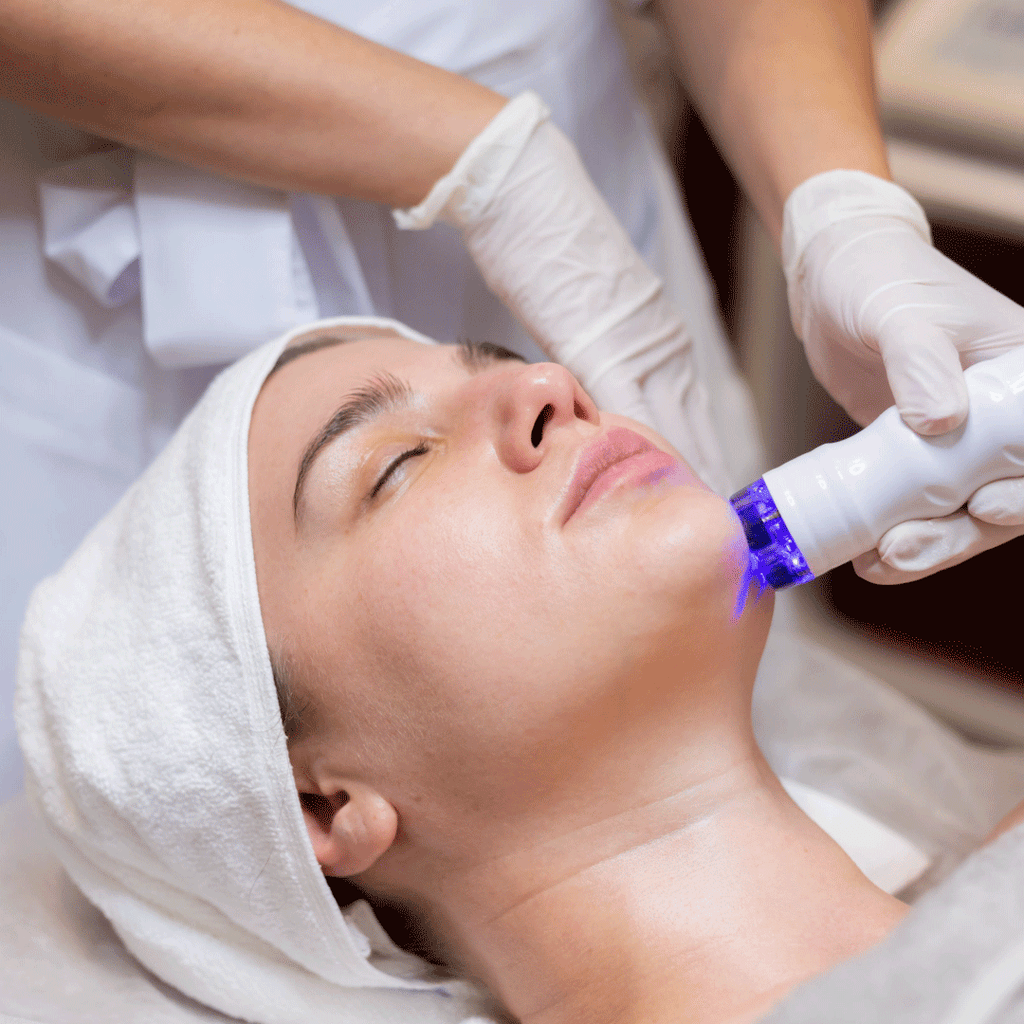 Pimple Acne Scar Laser Treatment | Chrysalis 