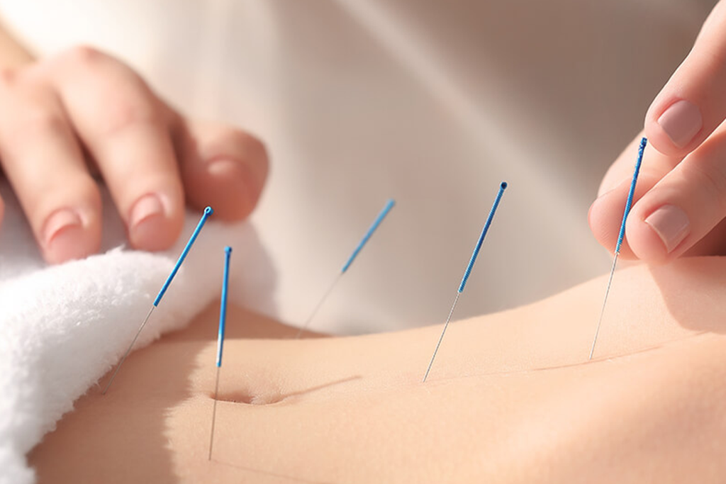 Does Acupuncture Hurt | Chrysalis