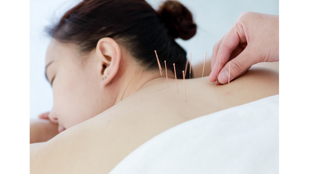 acupuncture at singapore | Chrysalis