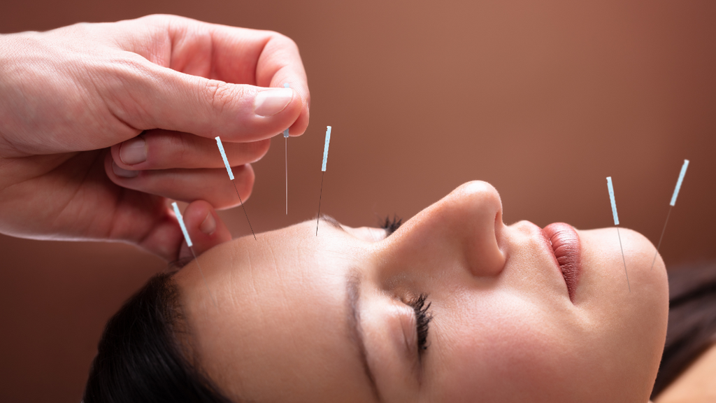 acupuncture local singapore | Chrysalis