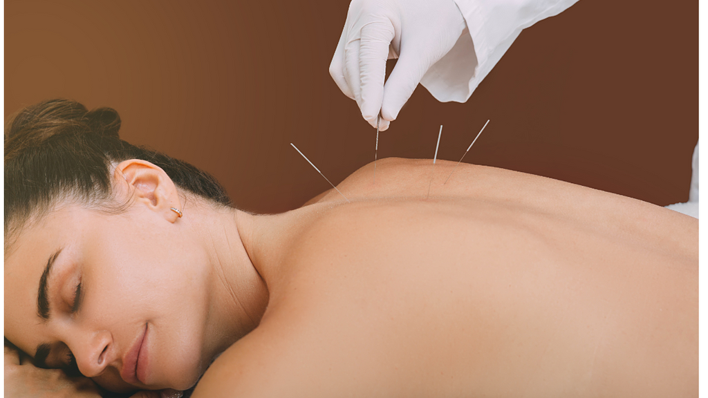 acupuncture in singapore | Chrysalis