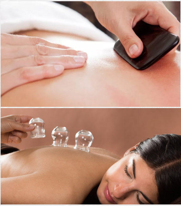 Cupping Massage Near Me | Chrysalis Spa 
