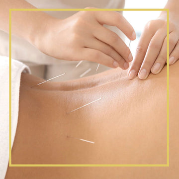 Acupuncture | Chrysalis Spa