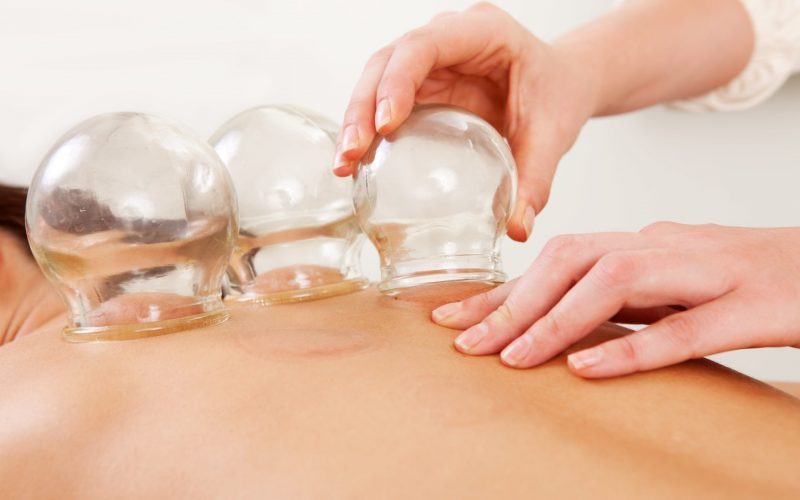 Cupping Therapy Benefits | Chrysalis